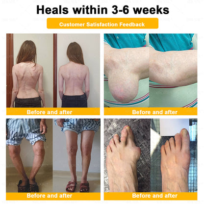 🌟XRLXRL® Bee-Venom Pain-Relief Bone Healing Cream (Specially for older adults)